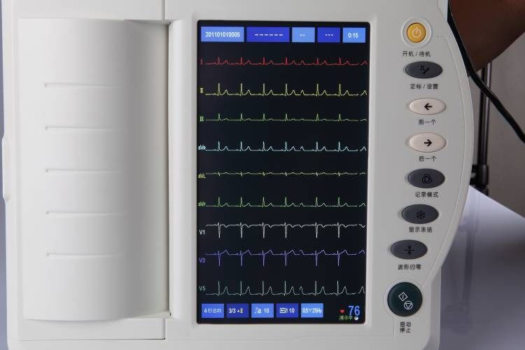 Máquina de ECG humano examen cardíaco cardiología máquina de ECG de 12 canales máquina de electrocardiograma EKG ECG