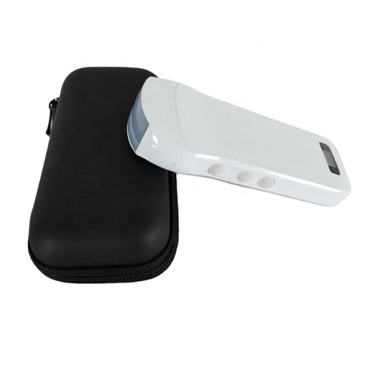 Usg Nuevo aspecto 3d imagen GYN imagen portátil Ob Gyn máquina de ultrasonido fetal color Doppler con alta calidad