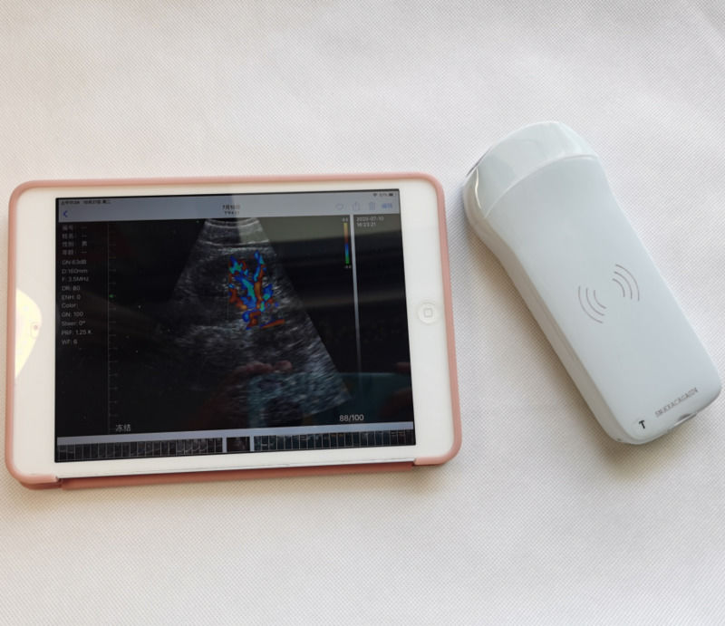 Usg Nuevo aspecto 3d imagen GYN imagen portátil Ob Gyn máquina de ultrasonido fetal color Doppler con alta calidad