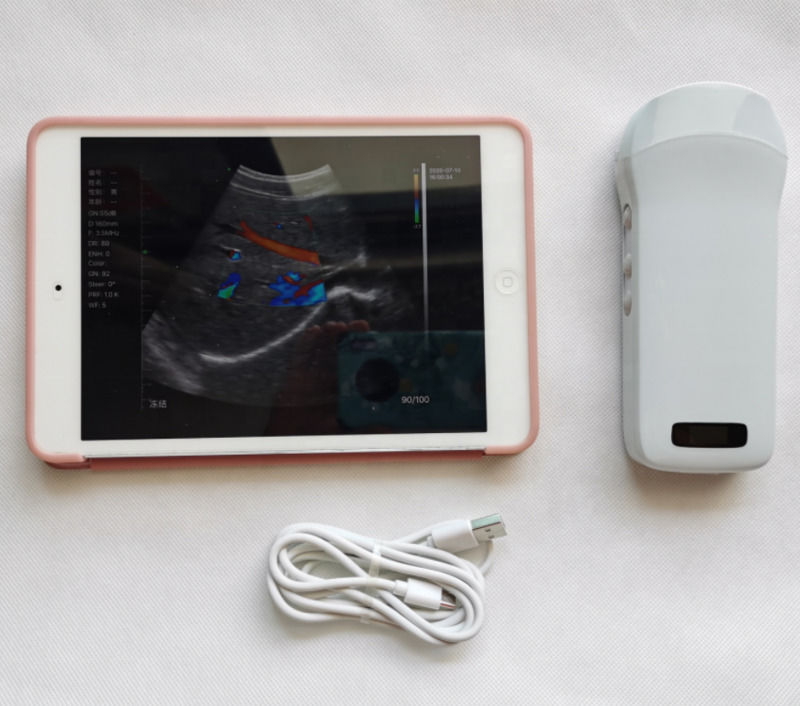 Usg Nuevo aspecto 3d imagen GYN imagen portátil Ob Gyn máquina de ultrasonido fetal color Doppler con alta calidad
