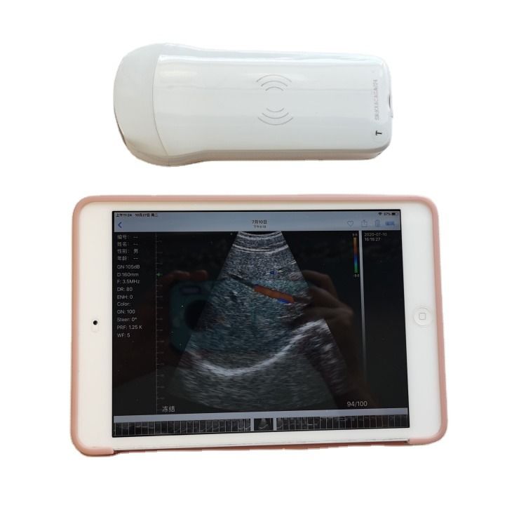 Máquina de ultrasonido veterinario portátil de alta calidad GYN, entrega rápida, diagnóstico 3D, para caballos, para vacas