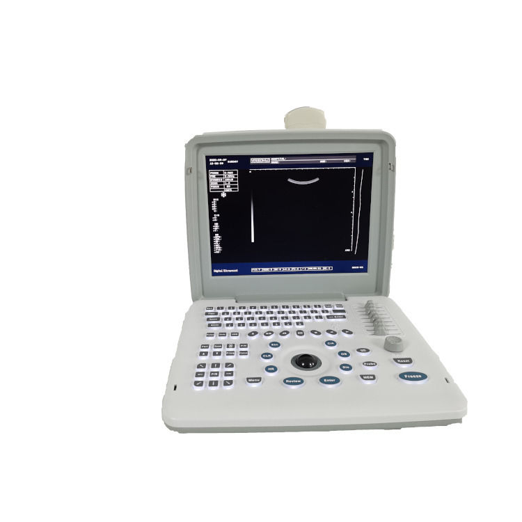 Máquina de ultrasonido fetal portátil con sonda Doppler para embarazo, escáner de radio, para bebé