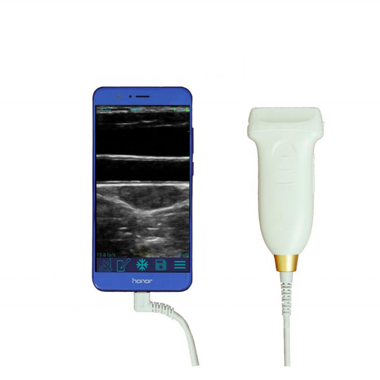 GYN Ultrasound Probe 3 en 1 usb wifi convex ultrasonido sondas inalámbricas para android