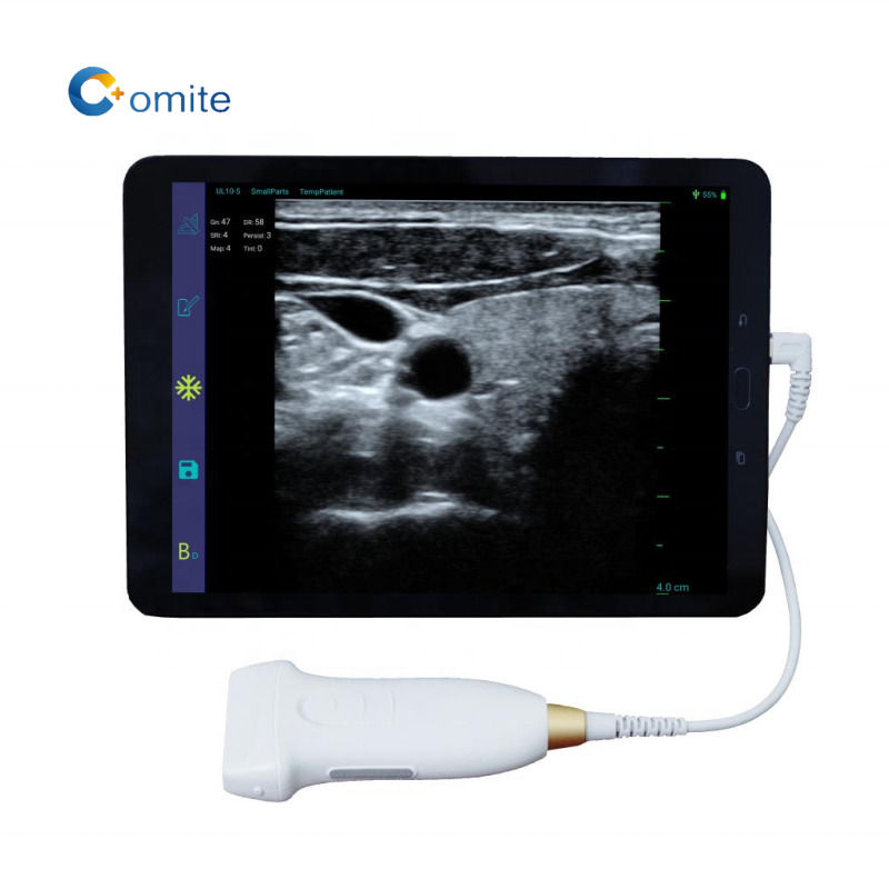 GYN Ultrasound Probe 3 en 1 usb wifi convex ultrasonido sondas inalámbricas para android