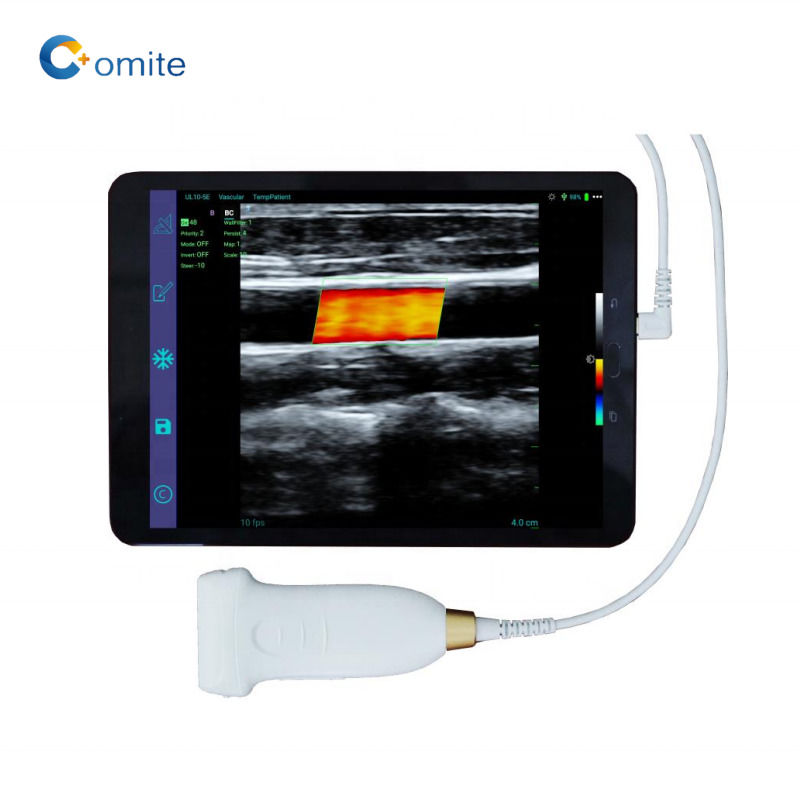 GYN Ultrasound Probe 3 en 1 usb wifi convex ultrasonido sondas inalámbricas para android