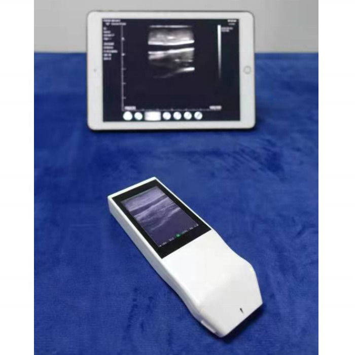 Proba de color inalámbrica WIFI GYN Ultrasonido Proba lineal con pantalla Anestesia punción Navegación Ultrasonido portátil