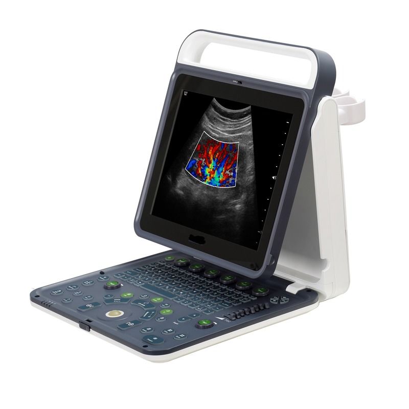 Hospital afuera 2020 Nuevo portátil digital de 15 pulgadas máquina de ultrasonido Doppler de color