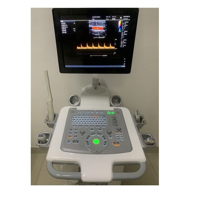 El hospital fuera del carrito 15 pulgadas máquina de ultrasonido ultrasonido digital color Doppler máquinas de ultrasonido édico