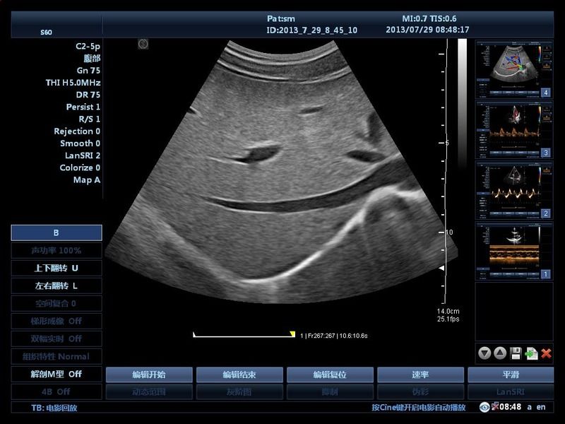 El hospital fuera del carrito 15 pulgadas máquina de ultrasonido ultrasonido digital color Doppler máquinas de ultrasonido édico