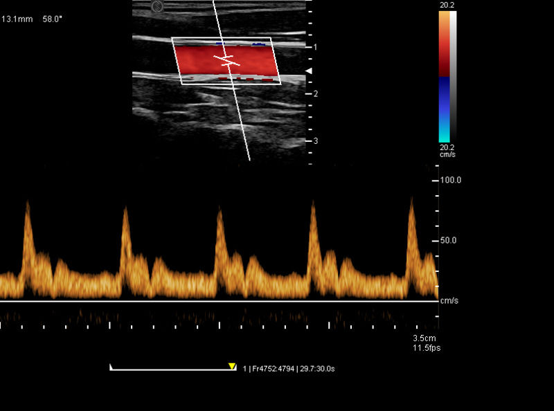 China Carro Digital Color Doppler Ultrasonido Médico Máquina de Ultrasonido Ultrasonido Hospital Exterior
