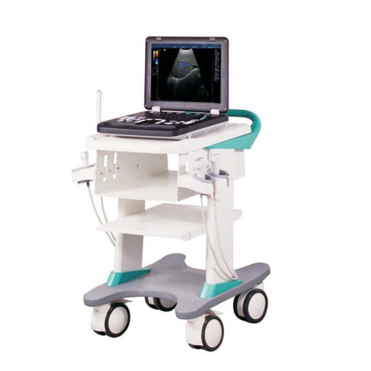 Máquina de ultrasonido de ecocardiografía Doppler color portátil garantizada al 100%