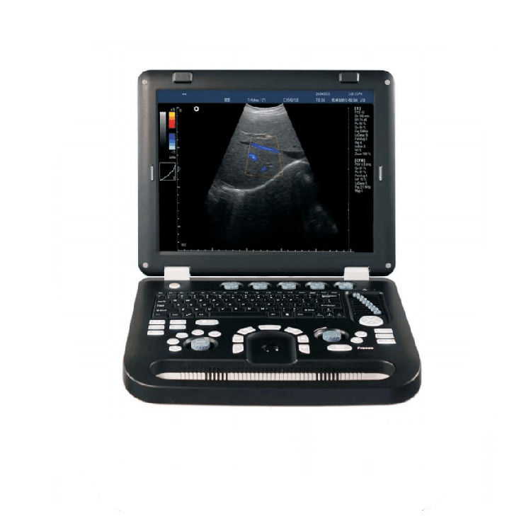 Máquina de ultrasonido de ecocardiografía Doppler color portátil garantizada al 100%