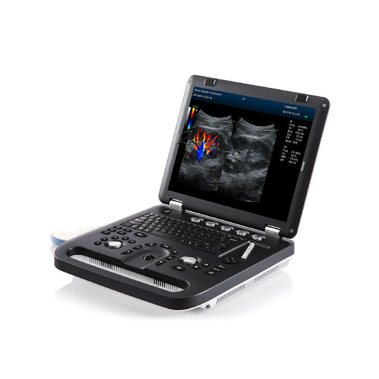 Máquina de ultrasonido de ecocardiografía Doppler color portátil garantizada al 100%