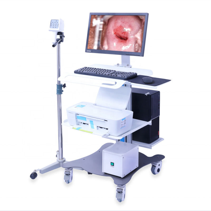 Colposcopio ginecológico portátil Sistema de imagen digital del colposcopio Examen vaginal Video colposcopio para ginecología