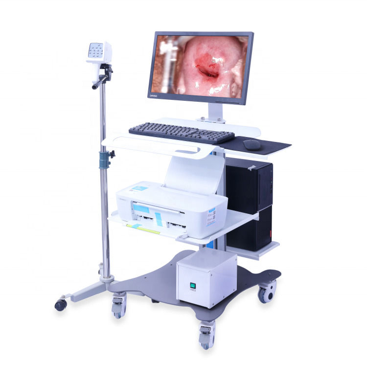 Colposcopio ginecológico portátil Sistema de imagen digital del colposcopio Examen vaginal Video colposcopio para ginecología